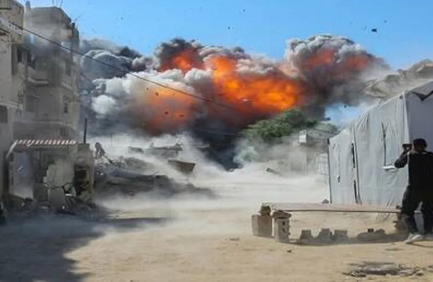كارثة وبائية في غزة: 5 آلاف إصابة أسبوعياً بـ”جدري الماء” وظهور “السل” يستدعي تدخلاً عاجلاً